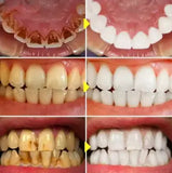 Teeth Whitening Essence Pen