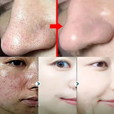 Green Tea Blackhead Remover Stick Mask for Acne & Pore Care